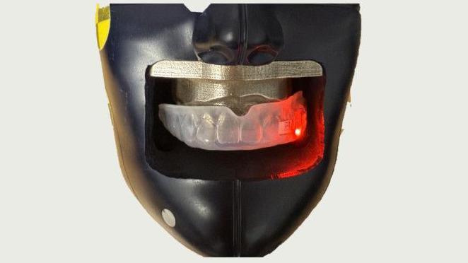 Revolutionizing Player Safety: Smart Mouthguards Debut at Women's Rugby World Cup