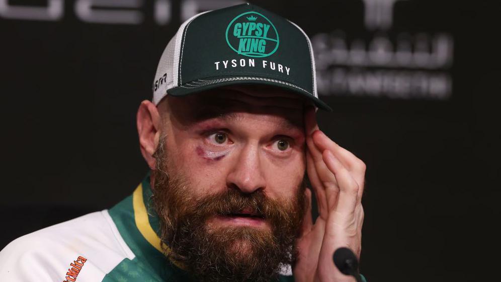 Tyson Fury's Retirement: The End of an Era in Boxing